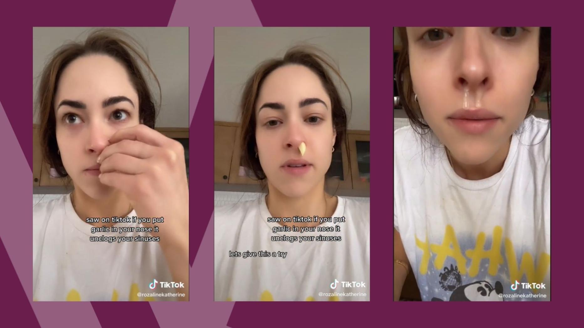 Garlic Nose Trend Machen Knoblauchzehen in der Nase die Atemwege frei?