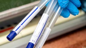 83 positive PCR-Tests wurden analysiert