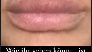 kleinste Lippen der Welt