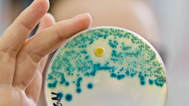 Hygiene reicht offensichtlich nicht, um gefährliche Bakterien loszuwerden