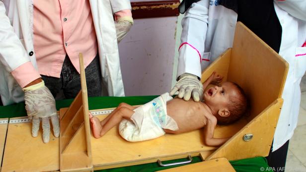 Mehrere Faktoren könnten in Yemen zu einer Hungersnot führen