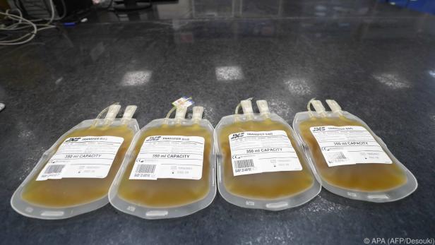Plasmaspende bleibt trotzdem für das Blutspendewesen wichtig