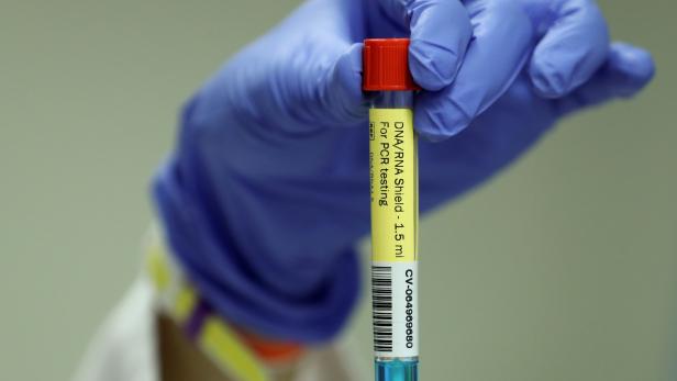 A laboratory worker shows a PCR test at the University of Liege