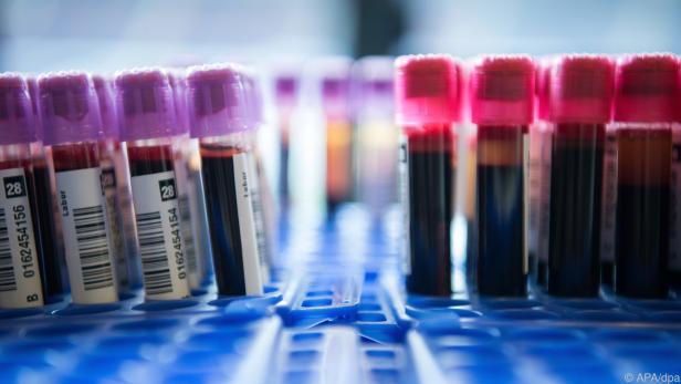 Zerfallen Krebszellen, gelangen tumortypische Proteine ins Blut