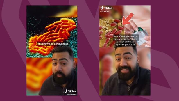 TikTok-Arzt warnt vor "fleischfressender" Geschlechtskrankheit