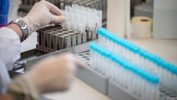 Bei der Auswertung der PCR-Tests gibt es weiter Probleme
