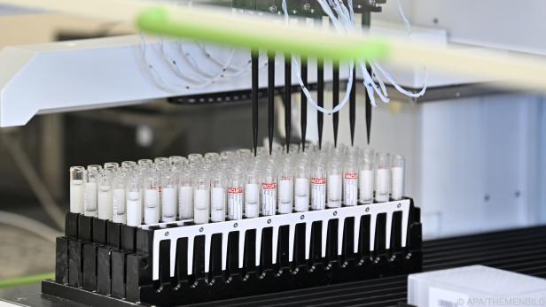 Die Kritik an der ARGE für die PCR-Test an Schulen reißt nicht ab