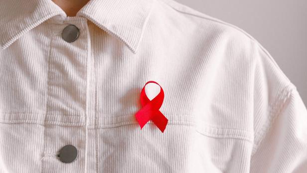 Aggressivere HIV-Variante in den Niederlanden entdeckt