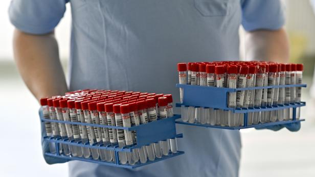 Die Firma Greiner stellt unter anderem die Plastikröhren für PCR-Tests her.