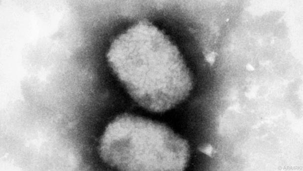Aufnahme eines Affenpockenvirus