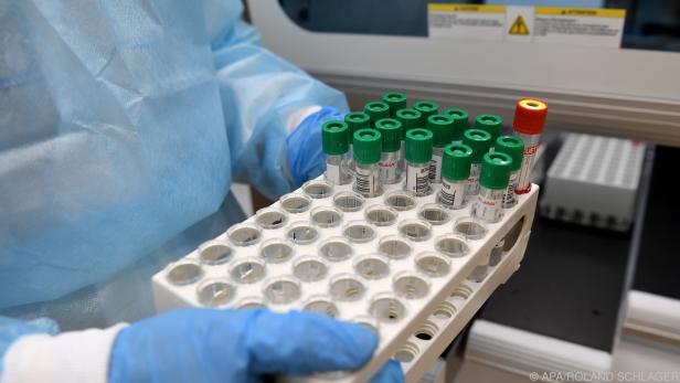 Nur 41.052 PCR-Tests mit Positivrate von 4,3 Prozent