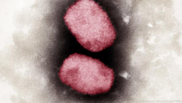 Mikroskopische Aufnahme von Affenpocken-Viren