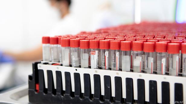 Bei Bedarf stehen den Schulen bald wieder PCR-Tests zur Verfügung.