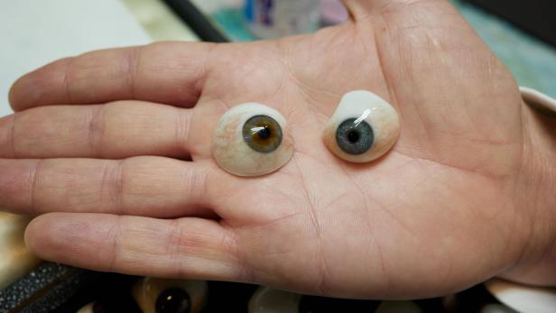 Zwei Augenprothesen, die auf einer flachen Hand liegen. Eine grün, eine blau.