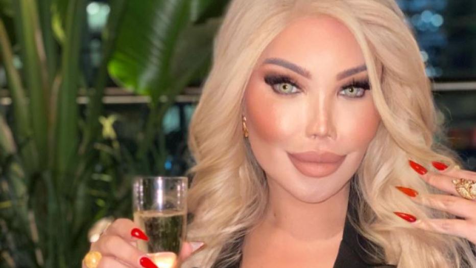 Transfrau Jessica Alves Lebt Als Real Life Barbie